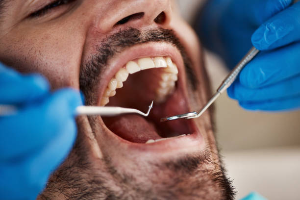 Best Emergency Dental Care for Abscessed Tooth in North Utica, IL