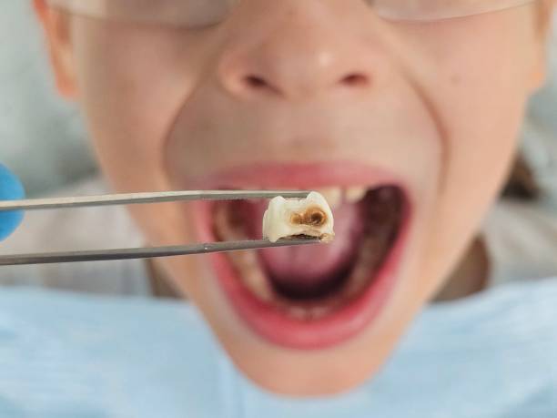 Best Holiday Emergency Dentist in North Utica, IL