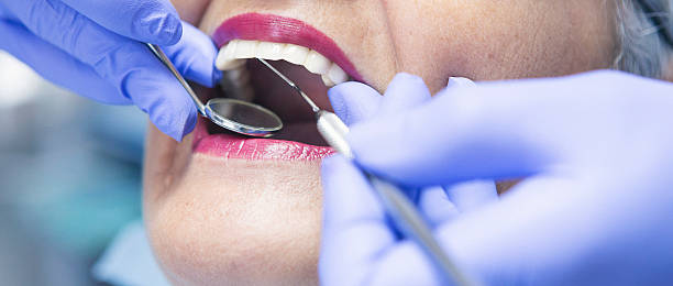 Best Emergency Dental Services for Seniors in North Utica, IL